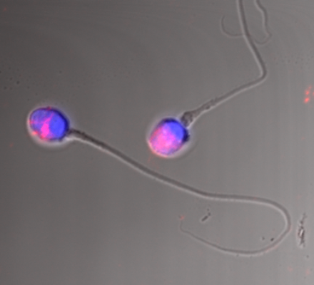 Zárodečné buňky ve zkumavce