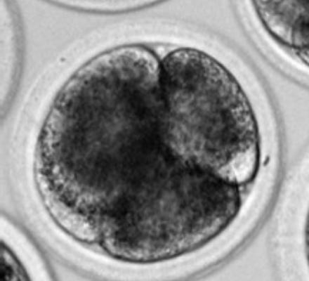 Umělá inteligence pro hodnocení embryí